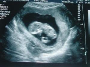 Pregnancy 12 weeks fetal development and womans sensations