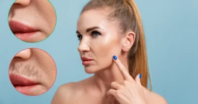 What Should You Do if You Have Excessive Hair Growth